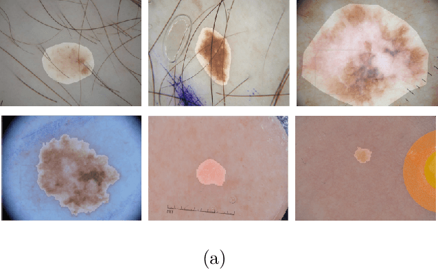 Figure 1 for Cascaded Context Enhancement for Automated Skin Lesion Segmentation