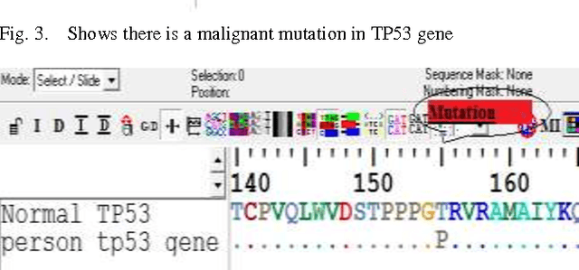 Figure 3 for Effective Data Mining Technique for Classification Cancers via Mutations in Gene using Neural Network