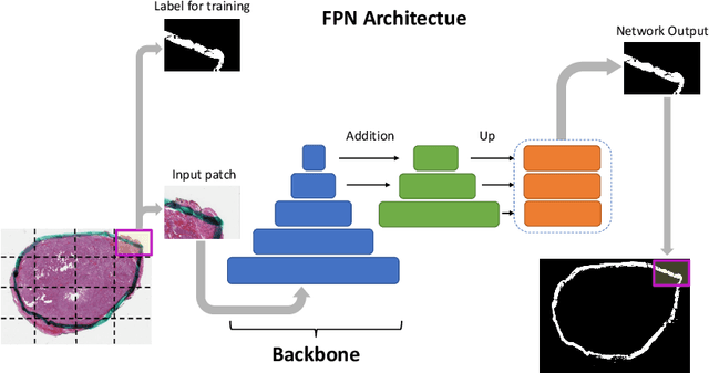 Figure 3 for Ink Marker Segmentation in Histopathology Images Using Deep Learning