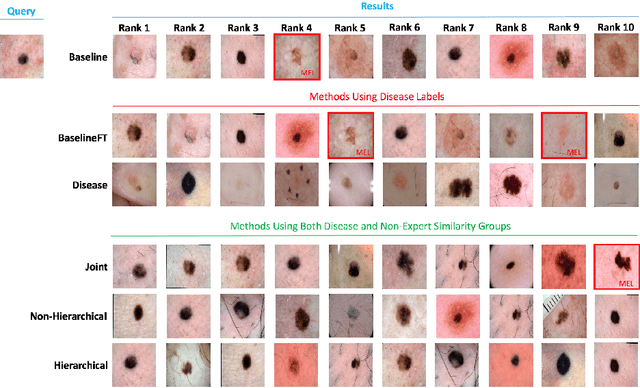 Figure 4 for Collaborative Human-AI (CHAI): Evidence-Based Interpretable Melanoma Classification in Dermoscopic Images