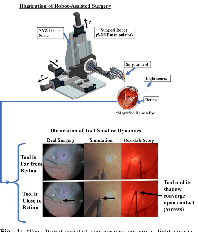 Figure 1 for Autonomously Navigating a Surgical Tool Inside the Eye by Learning from Demonstration