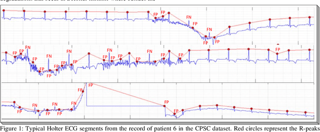 Figure 1 for Robust Peak Detection for Holter ECGs by Self-Organized Operational Neural Networks