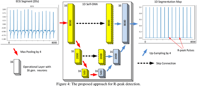 Figure 4 for Robust Peak Detection for Holter ECGs by Self-Organized Operational Neural Networks