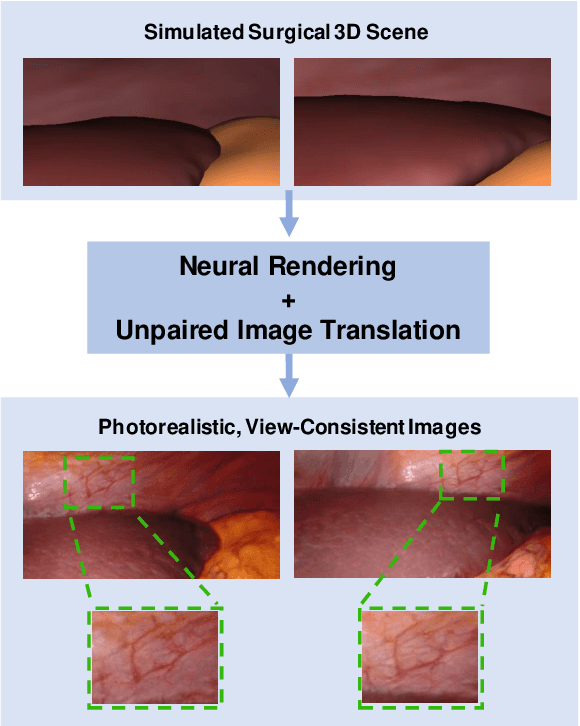 Figure 1 for Long-Term Temporally Consistent Unpaired Video Translation from Simulated Surgical 3D Data