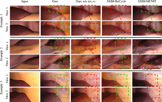 Figure 4 for Long-Term Temporally Consistent Unpaired Video Translation from Simulated Surgical 3D Data