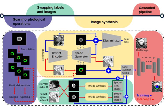 Figure 2 for Optimized Automated Cardiac MR Scar Quantification with GAN-Based Data Augmentation