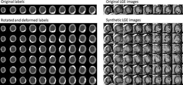Figure 4 for Optimized Automated Cardiac MR Scar Quantification with GAN-Based Data Augmentation