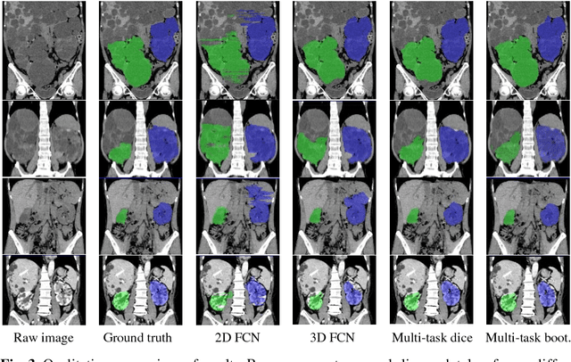 Figure 4 for Computation of Total Kidney Volume from CT images in Autosomal Dominant Polycystic Kidney Disease using Multi-Task 3D Convolutional Neural Networks