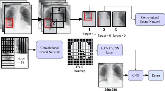 Figure 3 for PneumoXttention: A CNN compensating for Human Fallibility when Detecting Pneumonia through CXR images with Attention