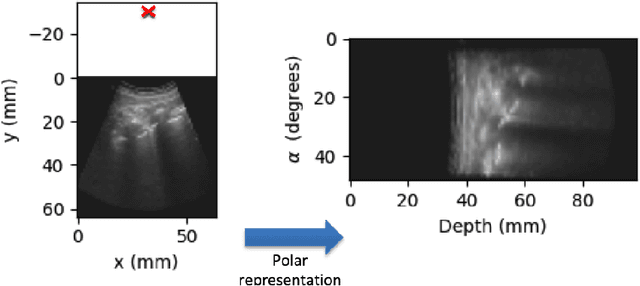 Figure 4 for B-line Detection in Lung Ultrasound Videos: Cartesian vs Polar Representation