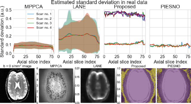 Figure 3 for Automatic, fast and robust characterization of noise distributions for diffusion MRI