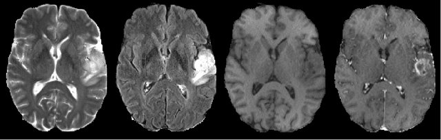 Figure 1 for 3D Convolutional Neural Networks for Tumor Segmentation using Long-range 2D Context