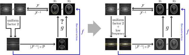 Figure 3 for Deep learning for undersampled MRI reconstruction