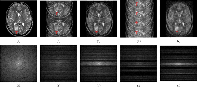 Figure 4 for Deep learning for undersampled MRI reconstruction