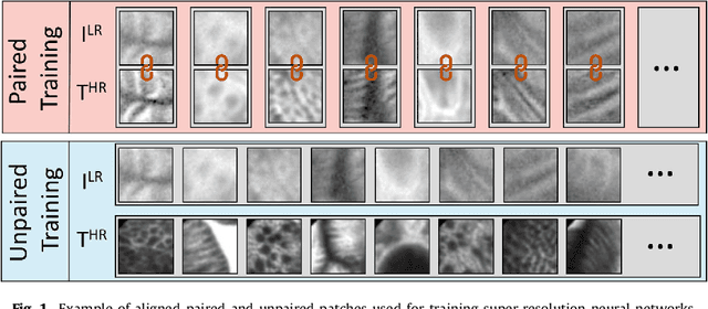 Figure 1 for Adversarial training with cycle consistency for unsupervised super-resolution in endomicroscopy