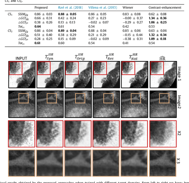 Figure 4 for Adversarial training with cycle consistency for unsupervised super-resolution in endomicroscopy