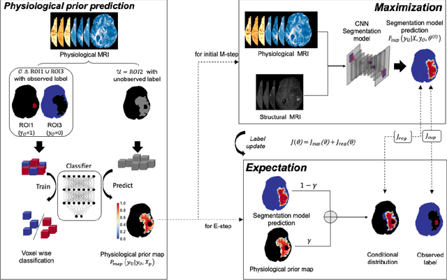 Figure 1 for Expectation-Maximization Regularized Deep Learning for Weakly Supervised Tumor Segmentation for Glioblastoma