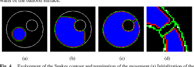 Figure 4 for Physical Modeling Techniques in Active Contours for Image Segmentation