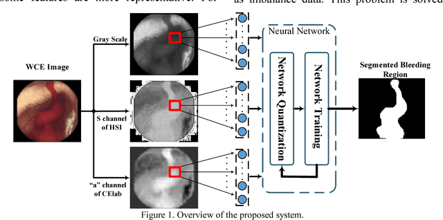 Figure 1 for Segmentation of Bleeding Regions in Wireless Capsule Endoscopy Images an Approach for inside Capsule Video Summarization