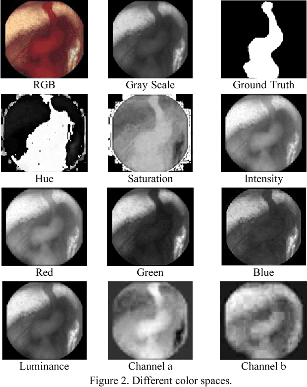 Figure 3 for Segmentation of Bleeding Regions in Wireless Capsule Endoscopy Images an Approach for inside Capsule Video Summarization
