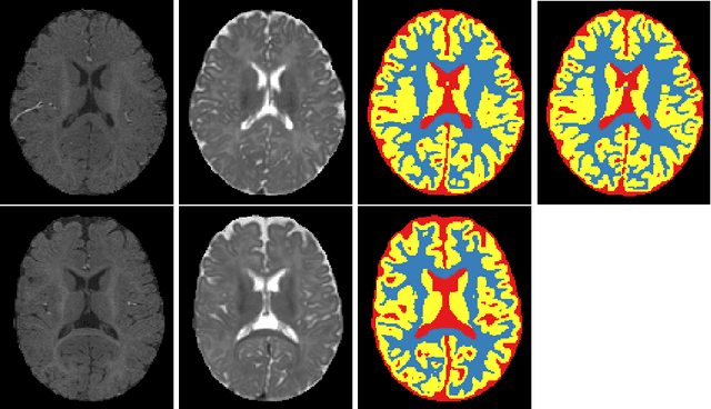 Figure 2 for Isointense infant brain MRI segmentation with a dilated convolutional neural network