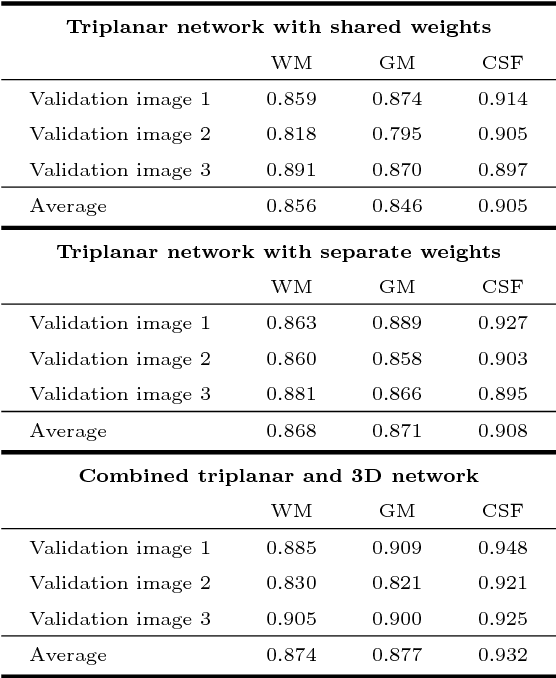 Figure 3 for Isointense infant brain MRI segmentation with a dilated convolutional neural network