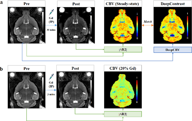 Figure 1 for Substituting Gadolinium in Brain MRI Using DeepContrast