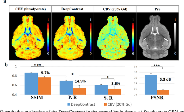 Figure 3 for Substituting Gadolinium in Brain MRI Using DeepContrast
