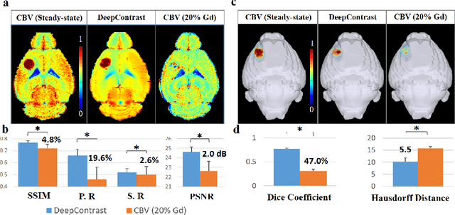Figure 4 for Substituting Gadolinium in Brain MRI Using DeepContrast
