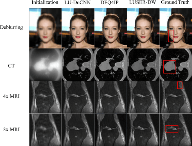 Figure 4 for Loop Unrolled Shallow Equilibrium Regularizer (LUSER) -- A Memory-Efficient Inverse Problem Solver