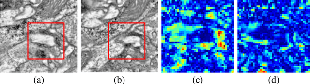 Figure 1 for ssEMnet: Serial-section Electron Microscopy Image Registration using a Spatial Transformer Network with Learned Features