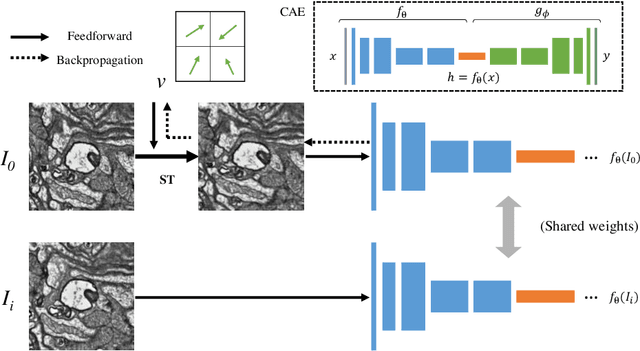 Figure 2 for ssEMnet: Serial-section Electron Microscopy Image Registration using a Spatial Transformer Network with Learned Features