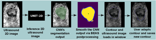 Figure 1 for Interactive Segmentation via Deep Learning and B-Spline Explicit Active Surfaces