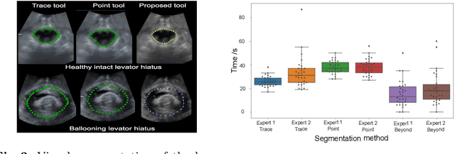 Figure 3 for Interactive Segmentation via Deep Learning and B-Spline Explicit Active Surfaces