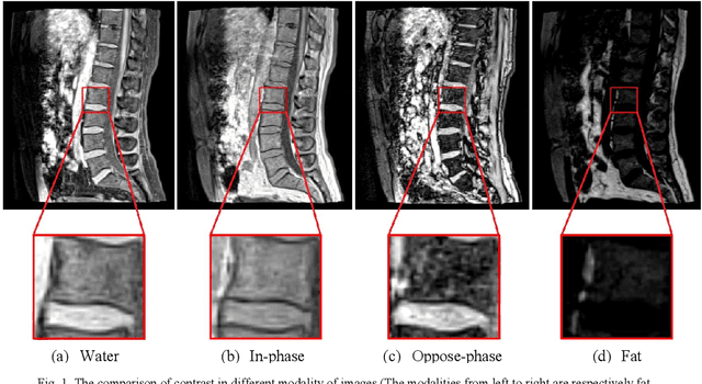 Figure 1 for Fully Automatic Intervertebral Disc Segmentation Using Multimodal 3D U-Net