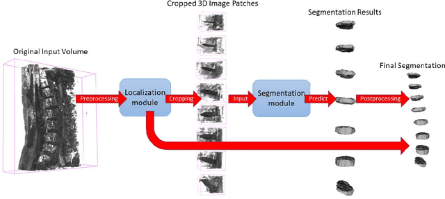 Figure 3 for Fully Automatic Intervertebral Disc Segmentation Using Multimodal 3D U-Net