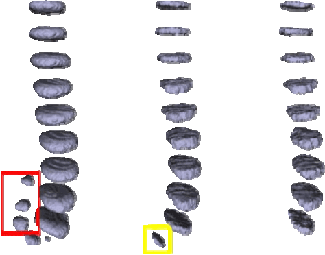 Figure 4 for Fully Automatic Intervertebral Disc Segmentation Using Multimodal 3D U-Net