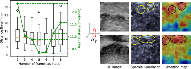Figure 4 for Sensorless Freehand 3D Ultrasound Reconstruction via Deep Contextual Learning
