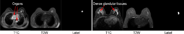 Figure 3 for Learning Cross-Modal Deep Representations for Multi-Modal MR Image Segmentation