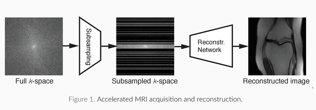 Figure 1 for Learning Fast Magnetic Resonance Imaging