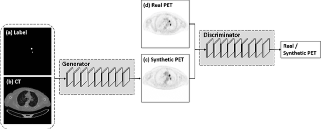 Figure 1 for Synthesis of Positron Emission Tomography (PET) Images via Multi-channel Generative Adversarial Networks (GANs)