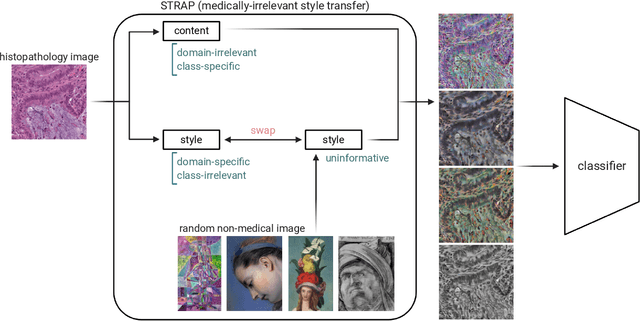 Figure 1 for Learning domain-agnostic visual representation for computational pathology using medically-irrelevant style transfer augmentation