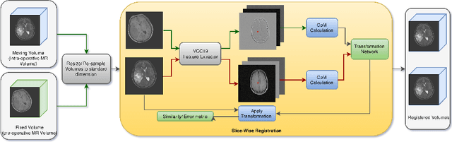 Figure 1 for Zero Shot Learning for Multi-Modal Real Time Image Registration
