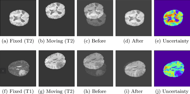 Figure 4 for Zero Shot Learning for Multi-Modal Real Time Image Registration