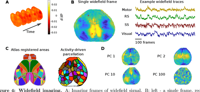 Figure 4 for Data Processing of Functional Optical Microscopy for Neuroscience