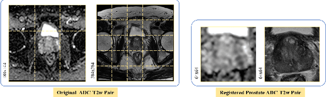 Figure 4 for Semi-supervised mp-MRI Data Synthesis with StitchLayer and Auxiliary Distance Maximization