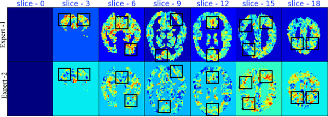Figure 4 for Mixture of Regression Experts in fMRI Encoding