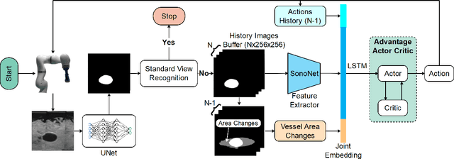 Figure 2 for VesNet-RL: Simulation-based Reinforcement Learning for Real-World US Probe Navigation