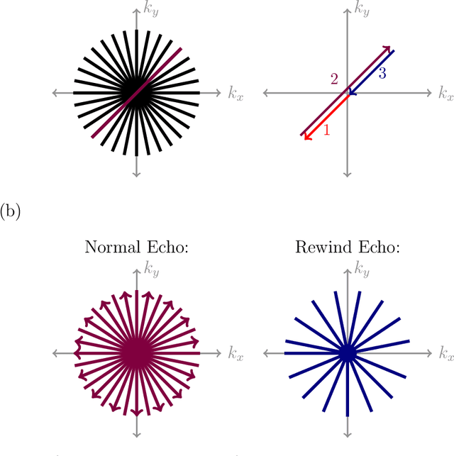 Figure 1 for BMART-Enabled Field-Map Combination of Projection-Reconstruction Phase-Cycled SSFP Cardiac Cine for Banding and Flow-Artifact Reduction