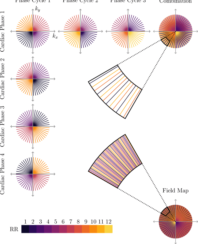 Figure 3 for BMART-Enabled Field-Map Combination of Projection-Reconstruction Phase-Cycled SSFP Cardiac Cine for Banding and Flow-Artifact Reduction